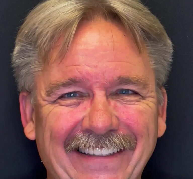 Long-term general dentistry patient result at D'Amico Dental Care, Wayland and Watertown MA