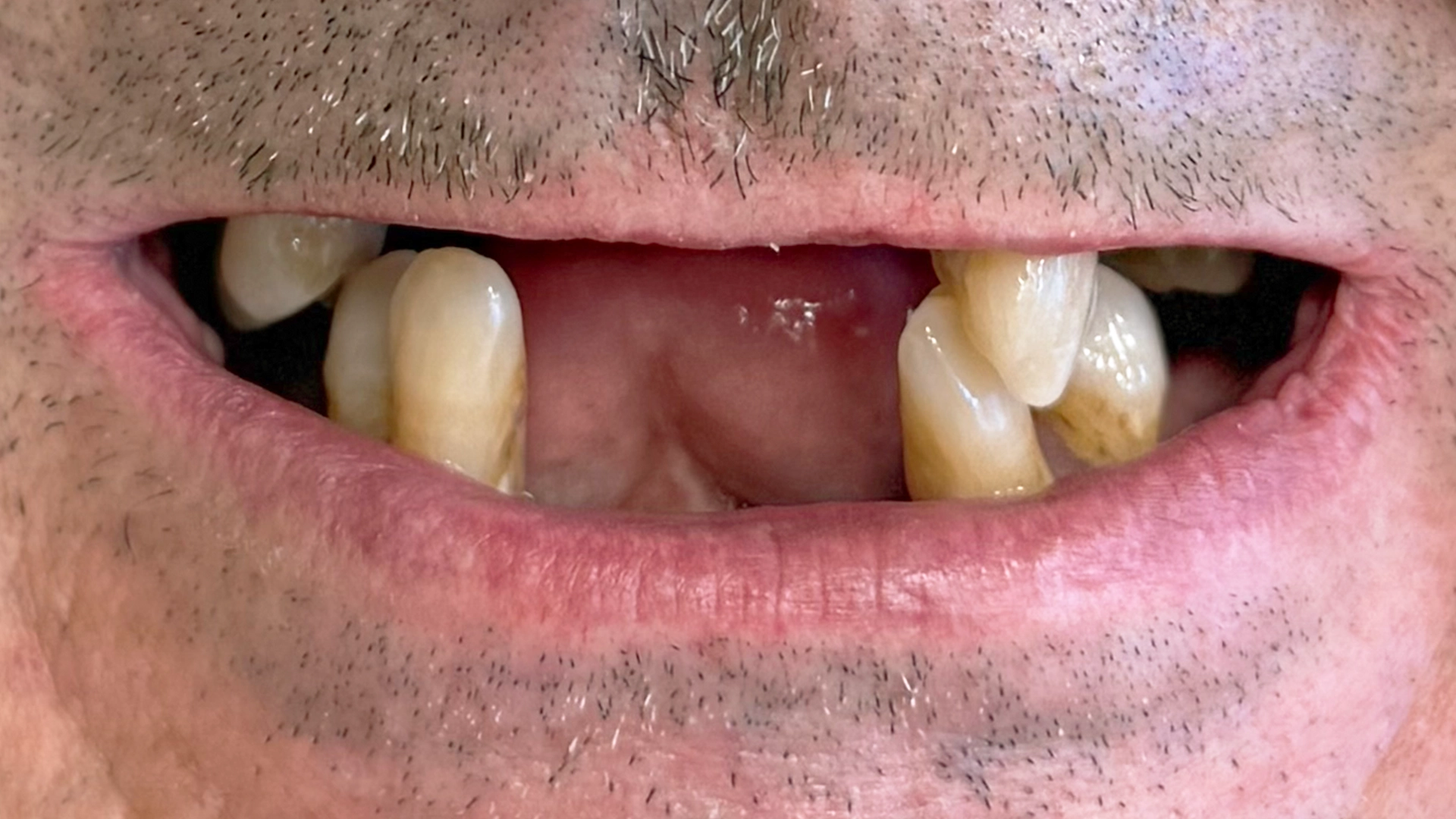 Case 2 Before dental treatment