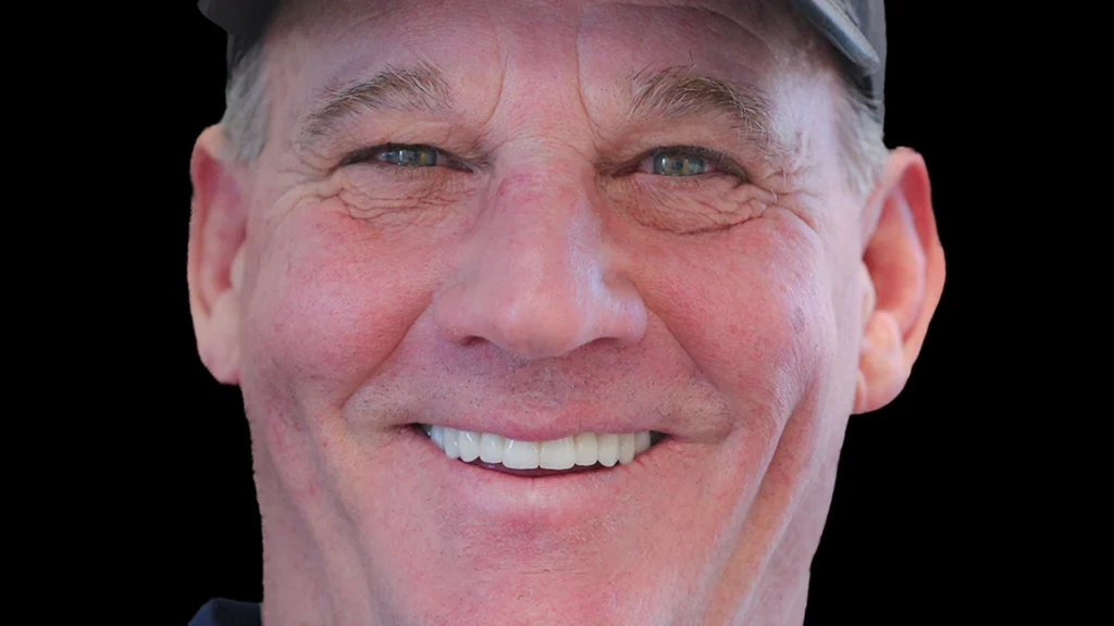 Restored natural-looking smile after general dentistry treatment at D'Amico Dental Care, Wayland MA
