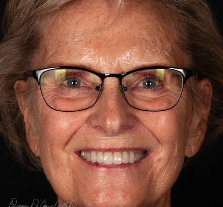 Smile after crown restoration at D'Amico Dental Care, Watertown MA