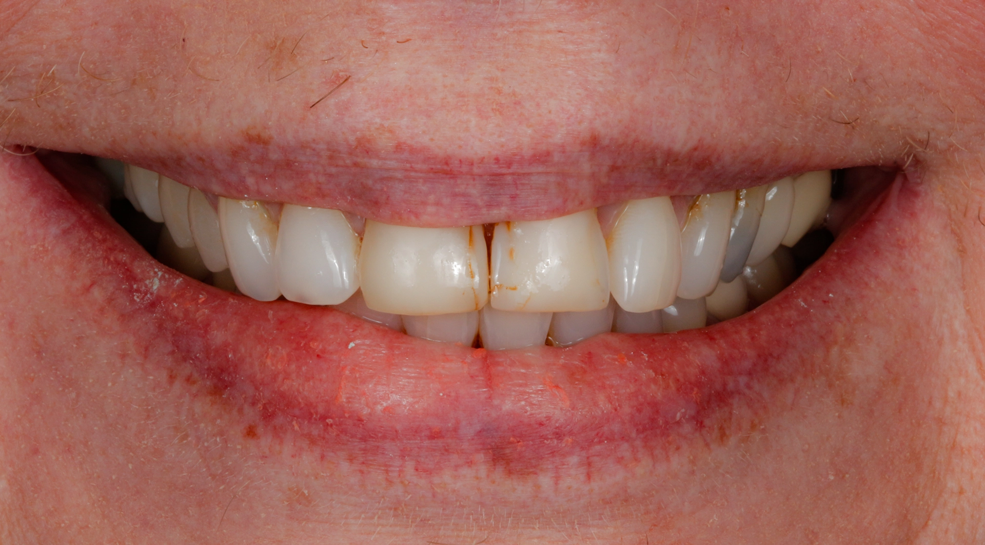 Before general dentistry treatment