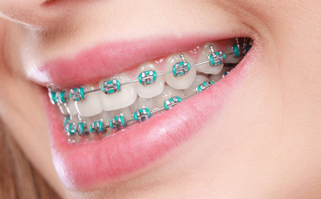 D'Amico Dental Care - Best Adult Orthodontics - var isDragging = false;