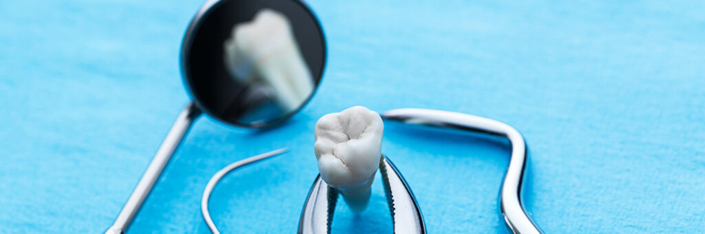 D'Amico Dental Care - Tooth Can’t Be Saved? Your Complete Guide to Painless Restoration at D’Amico Dental Care inWayland & Watertown MA. - If a dentist told you your tooth cannot be saved, it can feel shocking. But it does not mean your smile is finished.