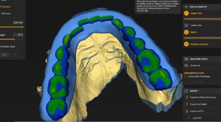 cost and price of digital smile design 3d dentistry